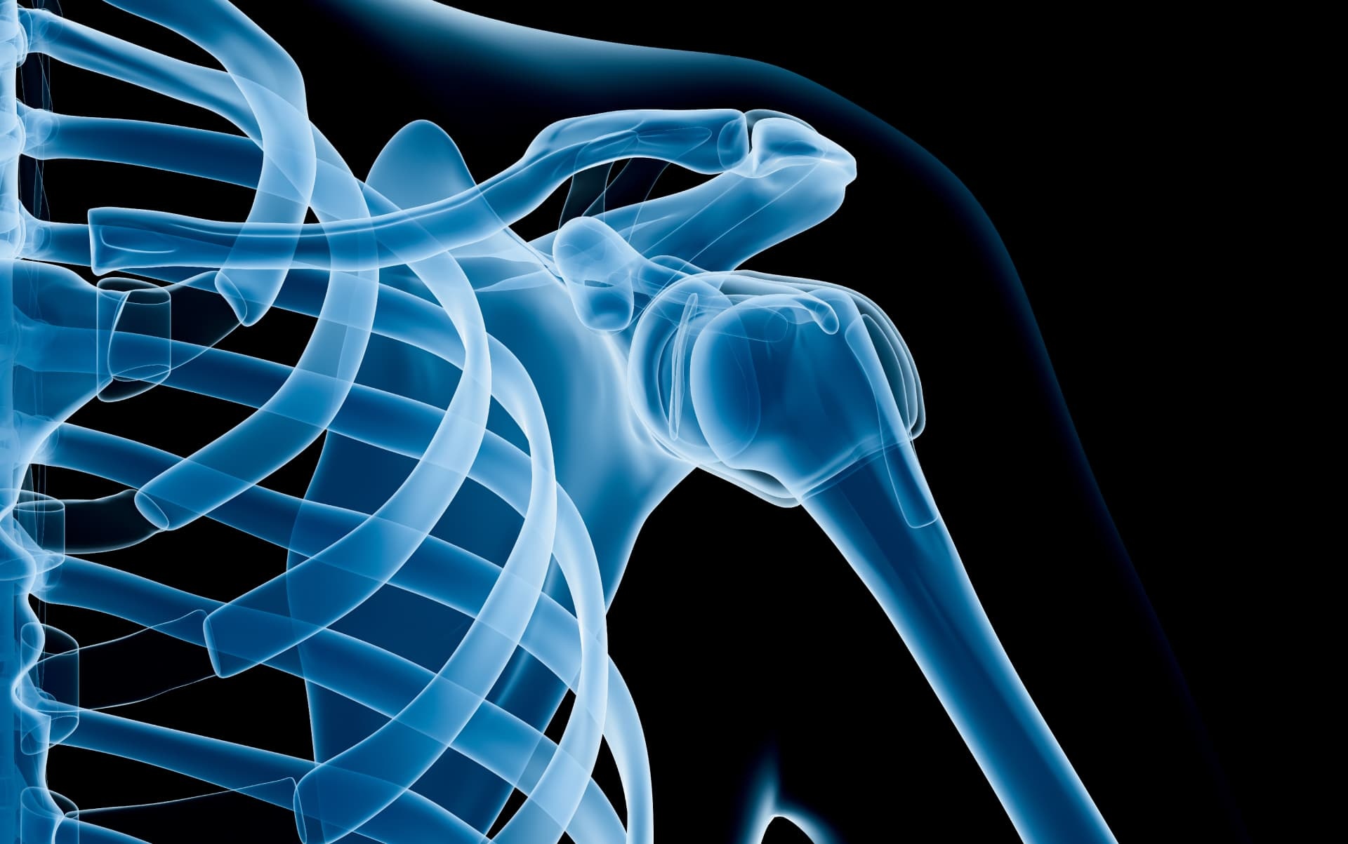 Hip Replacement Case Video